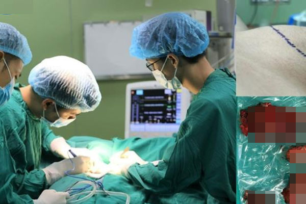 Vĩnh Phúc: Chàng trai phải cắt bỏ toàn bộ tuyến giáp vì ung thư sau khi có 2 dấu hiệu phổ biến nhiều người bỏ lỡ-1