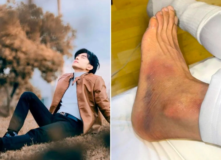 Đan Trường tiết lộ tình trạng sức khoẻ sau khi ngã cầu thang-1