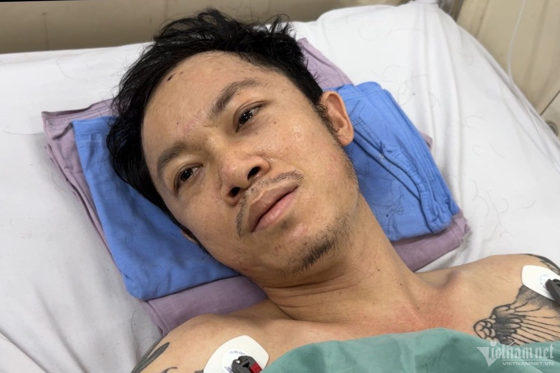 Nạn nhân vụ nổ lò hơi khiến 6 người tử vong kể về ngày đi làm định mệnh-3