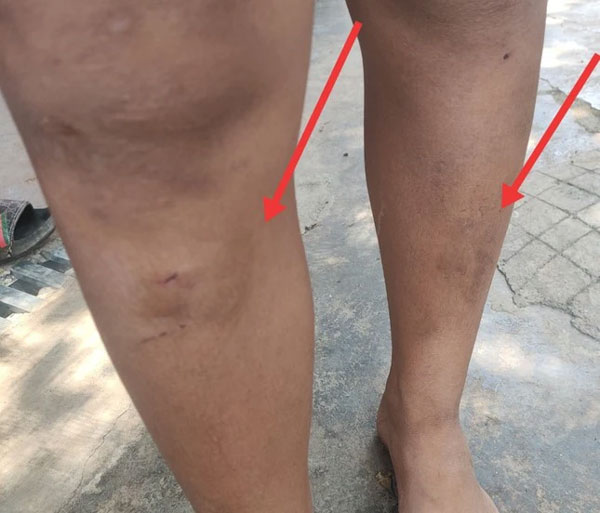 Ném đá văng vào nhà hàng xóm, 5 cháu nhỏ bị đánh bầm tím-1