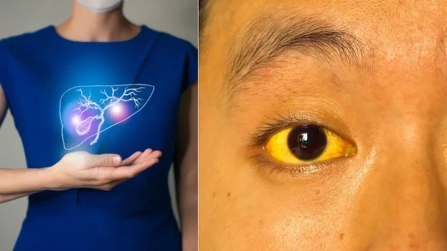 Người đoản thọ” thường có 5 đặc điểm trên khuôn mặt: Nếu không có tất cả chứng tỏ cơ thể vẫn khỏe mạnh-1