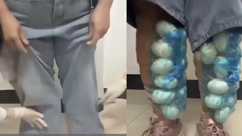 Phát hiện nữ du khách có dáng đi lạ, hải quan chặn lại kiểm tra: Vừa kéo ống quần lên, ai thấy cũng sốc!-1