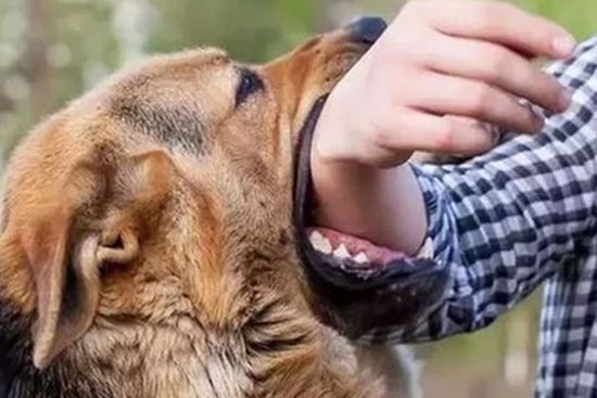Huế: Bé gái 7 tuổi cấp cứu vì bị chó dữ hàng xóm cắn