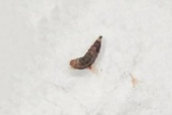 Bé gái bị thủng nhĩ vì có ấu trùng trong tai-2