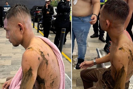 Hai ngôi sao đội tuyển Malaysia bị tạt axit và bị chém có nguy cơ nghỉ hết vòng loại World Cup 2026