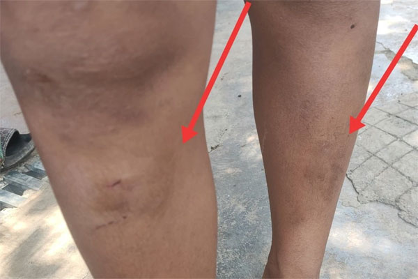 Vụ nam công nhân tử vong thương tâm tại nhà máy: Người tự ý sử dụng xe nâng bị xử lý thế nào?-2