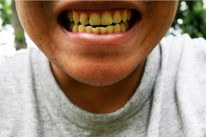 Hàm răng và điềm báo tài lộc: Khi nụ cười cũng là biểu tượng của giàu sang!-2