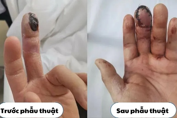 Người đàn ông bị hoại tử, phải cắt bỏ quá nửa ruột non vì ăn quá nhiều loại quả khoái khẩu của nhiều người-3