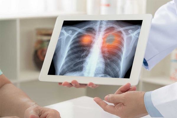 Phát hiện mới: Những người có 2 đặc điểm này sẽ có nguy cơ mắc ung thư đại tràng cao hơn-3