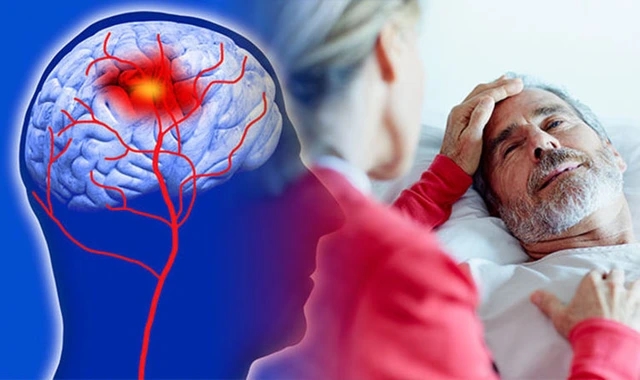 Người đàn ông 53 tuổi liệt nửa người, đột quỵ não giữa đêm: BS chỉ ra ngay 2 thói quen làm tăng nguy cơ-1