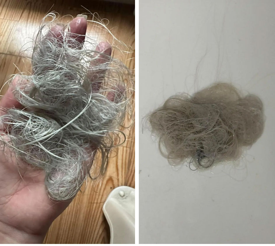 Kiếp nạn khi tẩy tóc: Làm hết 8.5 triệu, vẫn phải mua thêm bộ tóc giả về đội vì tóc rụng gần hết-4