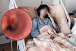 Cô gái Kiên Giang 26 tuổi tử vong chỉ sau 12 giờ phát hiện ung thư dạ dày, đâu là những biểu hiện sớm?