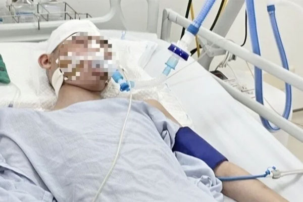 Chuyển nam sinh lớp 8 bị đánh chấn thương sọ não tới Bệnh viện Nhi Trung ương-2