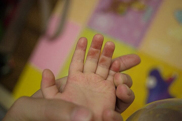 Thủ tướng Slovakia qua cơn nguy kịch sau vụ bị bắn-2