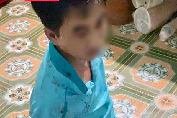 Luật sư phân tích tội danh của giám đốc xâm hại tình dục đồng tính thiếu niên 16 tuổi-2