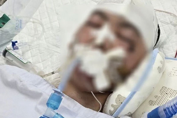 Nam sinh lớp 8 bị bạn học đánh chấn thương sọ não đã tử vong-2