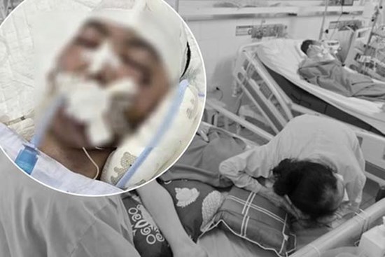 Nam sinh lớp 8 bị bạn học đánh chấn thương sọ não đã tử vong