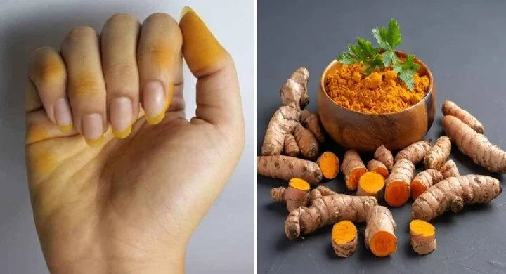 Tay dính nghệ vàng khè, cứ lấy những thứ này rửa là sạch-1