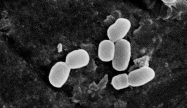 Soi kính hiển vi đội quân đất nung, những bông hoa” màu trắng nở rộ, chuyên gia: Ta đã phạm sai lầm lớn-3