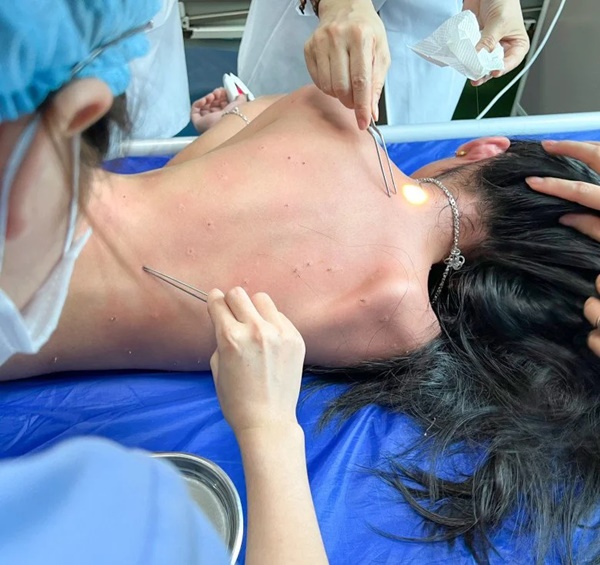 Vụ ong đốt người ở Hải Phòng: Tuyệt đối đừng la hét, đừng xua tay, chuyên gia nói bạn chỉ nên làm duy nhất một điều này-3