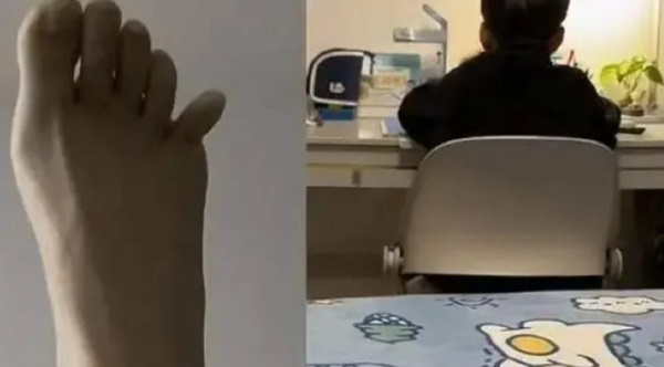 Nổi khùng khi kèm con học, ông bố cầm trái cây ném con vỡ lá lách-2