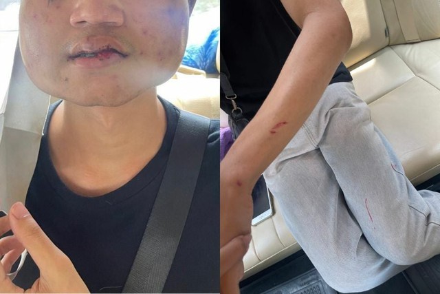 Hẹn hò qua mạng, anh chàng đến nhà đối phương để gặp gỡ, không ngờ trải nghiệm ám ảnh đang chờ sẵn-1