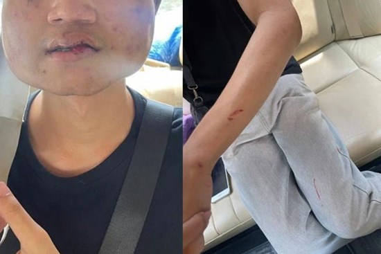 Hẹn hò qua mạng, anh chàng đến nhà đối phương để gặp gỡ, không ngờ trải nghiệm ám ảnh đang chờ sẵn