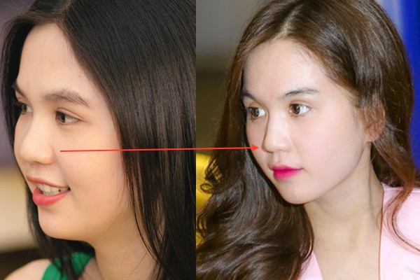 Ngọc Trinh bất ngờ lên tiếng chuyện sửa mũi-3