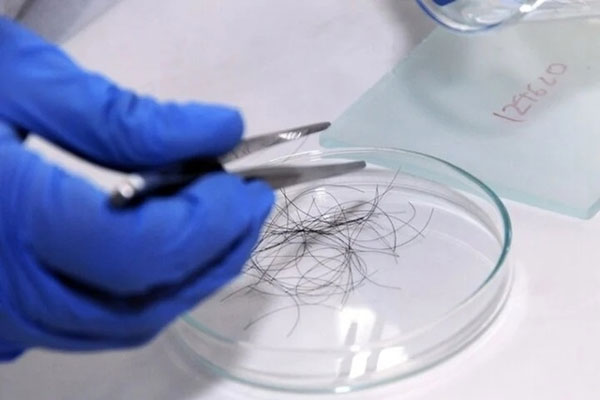 Cô gái mang tóc của 4 người đàn ông đi xét nghiệm ADN, kết quả khiến tất cả bất ngờ-1
