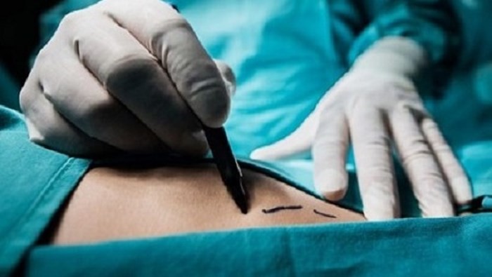 Báo Ukraine: Cựu Thứ trưởng Y tế đứng đầu đường dây đánh cắp nội tạng-1