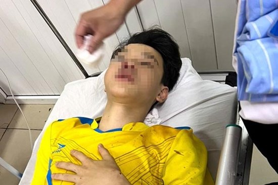 Trên đường đi thi lớp 10, nam sinh bị tai nạn phải bỏ thi
