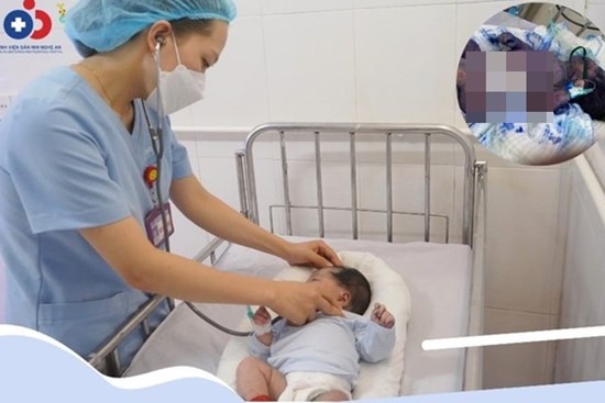 Nghệ An: Cứu sống hai trẻ sơ sinh nguy kịch do bị thủy đậu