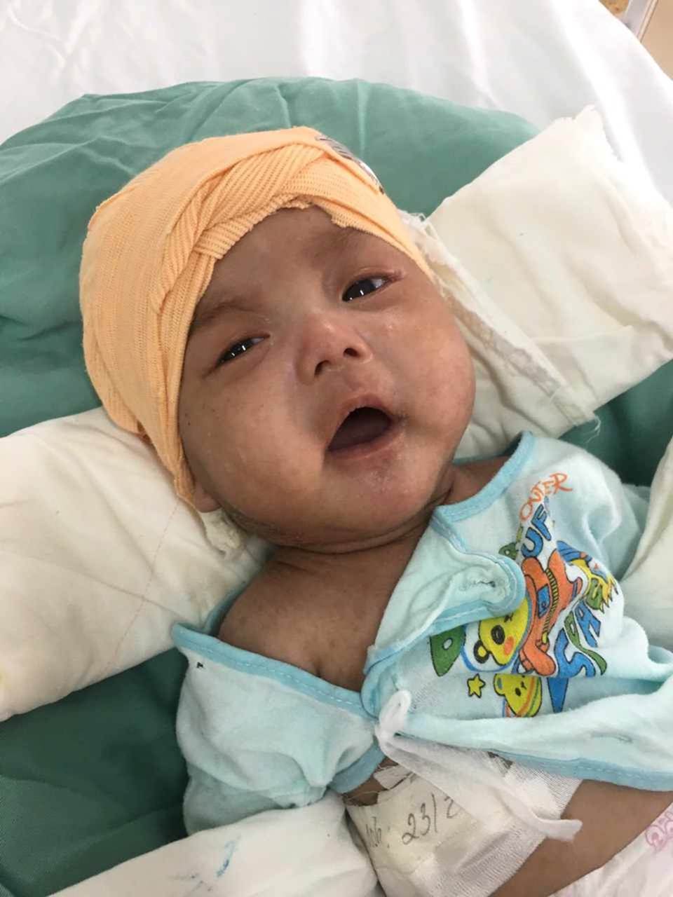 Ánh mắt cầu cứu của bé trai 5 tháng tuổi toàn thân lở loét vì căn bệnh quái ác-1