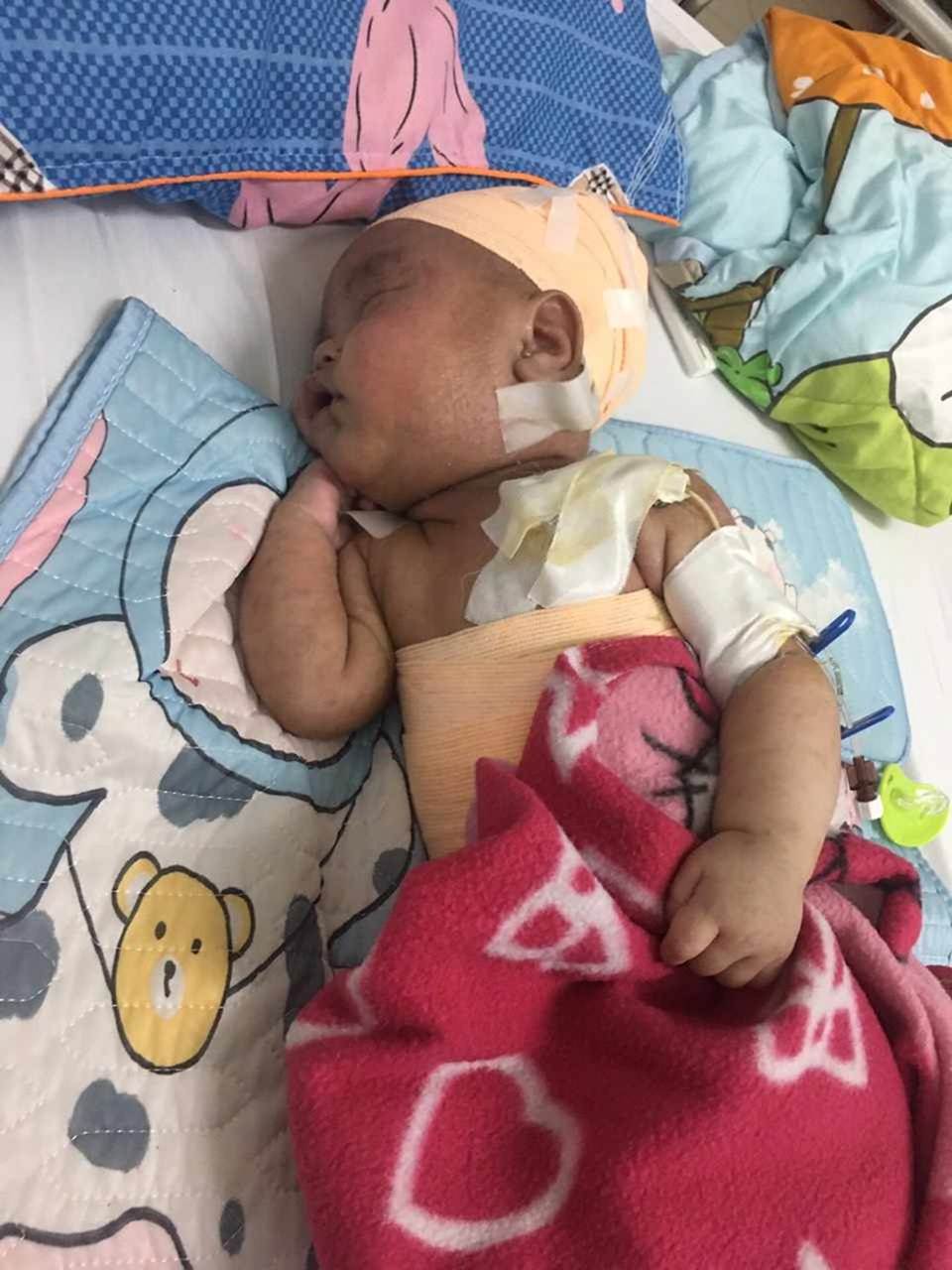 Ánh mắt cầu cứu của bé trai 5 tháng tuổi toàn thân lở loét vì căn bệnh quái ác-7