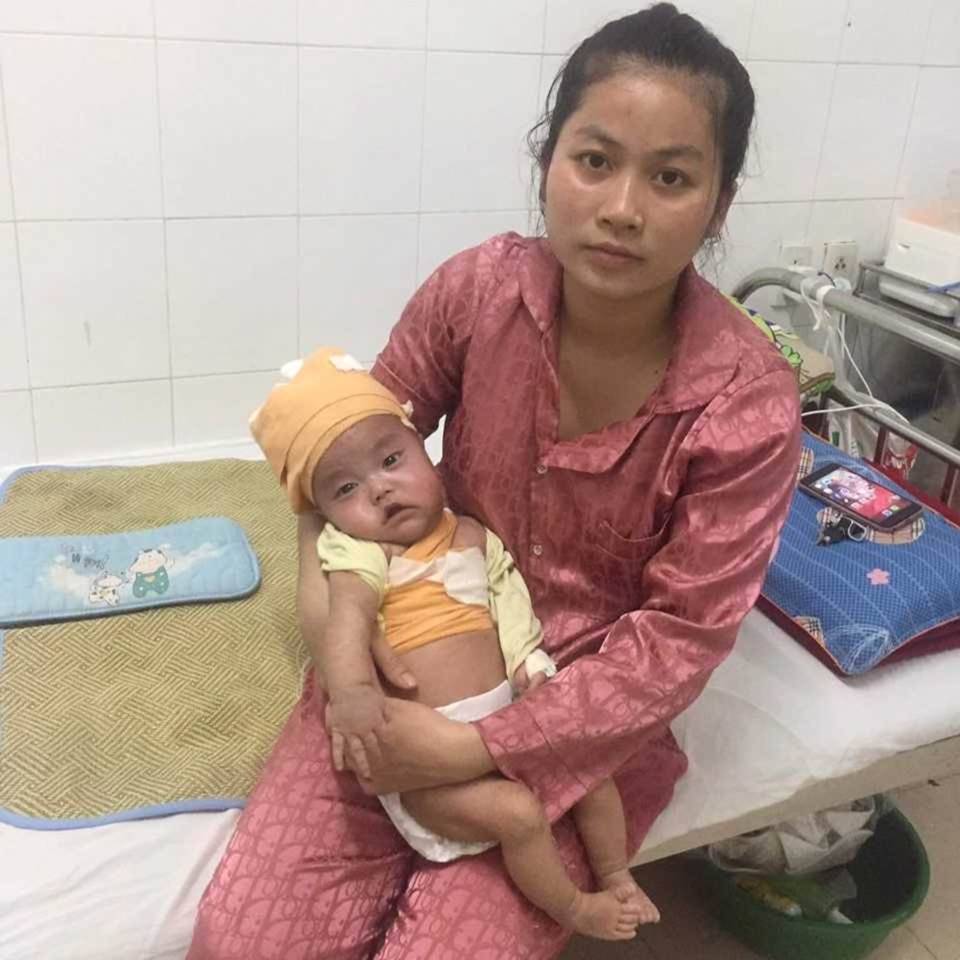 Ánh mắt cầu cứu của bé trai 5 tháng tuổi toàn thân lở loét vì căn bệnh quái ác-8