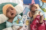 Ánh mắt cầu cứu của bé trai 5 tháng tuổi toàn thân lở loét vì căn bệnh quái ác