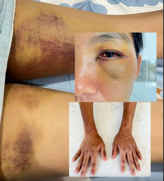 Cận cảnh nơi bà mẹ 3 con bị cả nhà chồng cũ giam cầm, đánh đập, bắt uống nước thải để trừ tà-9