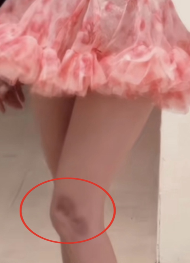 Vóc dáng hiện tại của Ngọc Trinh sau khi lộ khuyết điểm đáng báo động-4