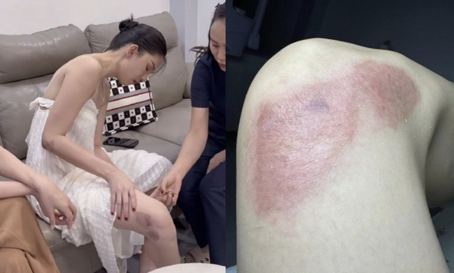 Vóc dáng hiện tại của Ngọc Trinh sau khi lộ khuyết điểm đáng báo động-9