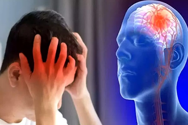 Người phụ nữ 39 tuổi bị đột quỵ với các triệu chứng bất thường-2