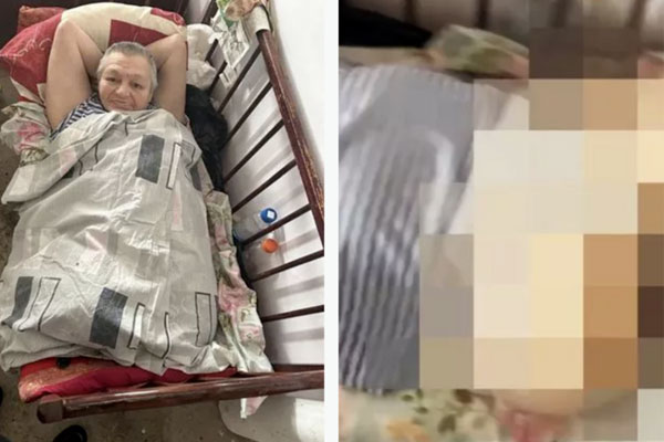 Bị chuột ăn thịt trong khi say rượu, người phụ nữ mất cả 2 chân-2