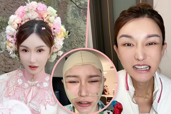 Chi 4,6 tỷ để thẩm mỹ gương mặt, KOL nổi danh khiến 2,2 triệu fan sốc nặng vì ngoại hình biến dạng khó nhận ra-1