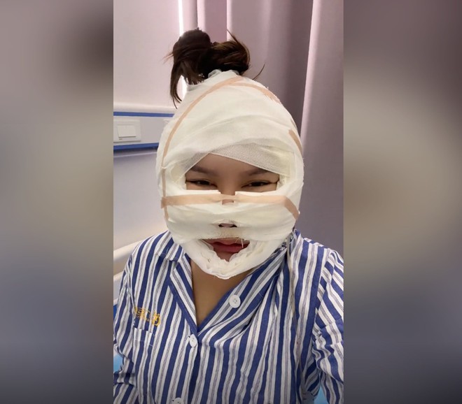 Chi 4,6 tỷ để thẩm mỹ gương mặt, KOL nổi danh khiến 2,2 triệu fan sốc nặng vì ngoại hình biến dạng khó nhận ra-2