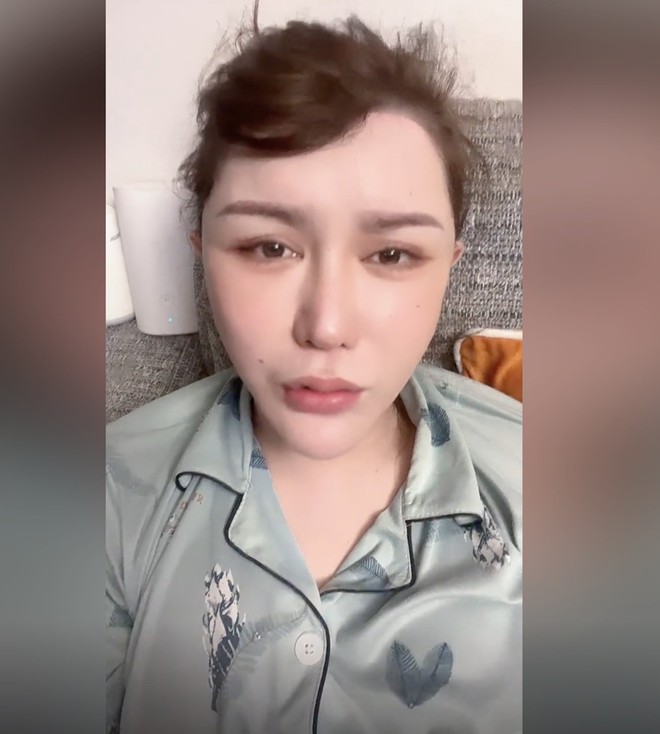 Chi 4,6 tỷ để thẩm mỹ gương mặt, KOL nổi danh khiến 2,2 triệu fan sốc nặng vì ngoại hình biến dạng khó nhận ra-3