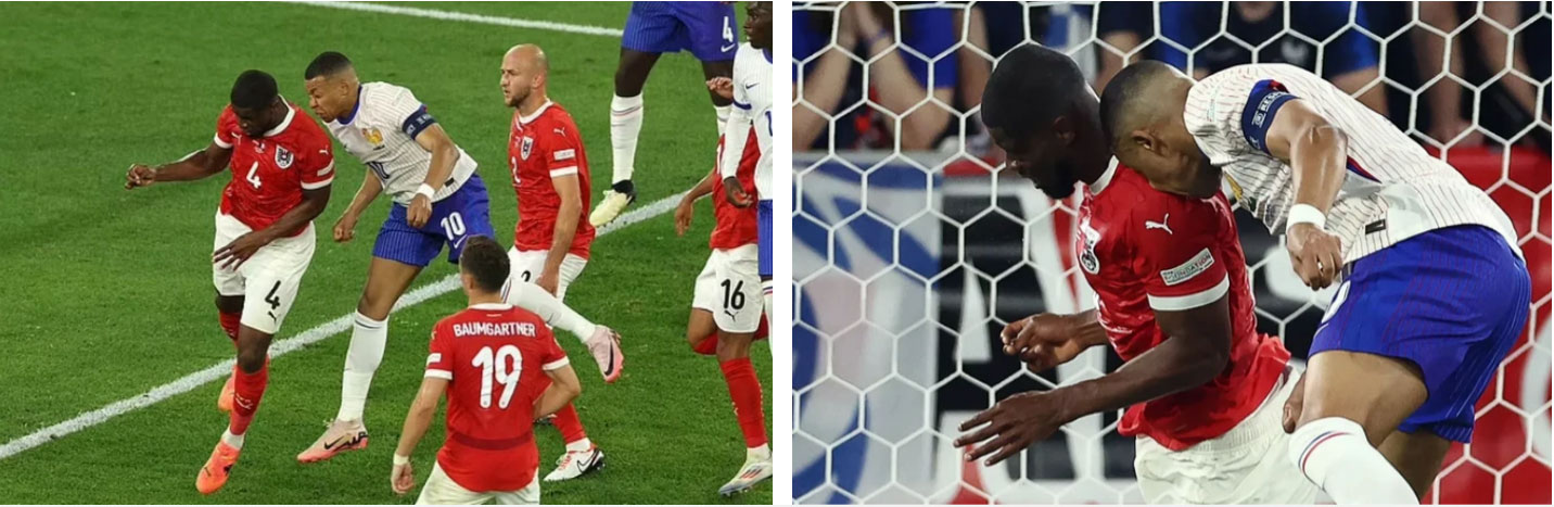 Ngôi sao số 1 của tuyển Pháp chấn thương kinh dị: Gãy mũi, đổ máu, phải đi thẳng vào bệnh viện-1