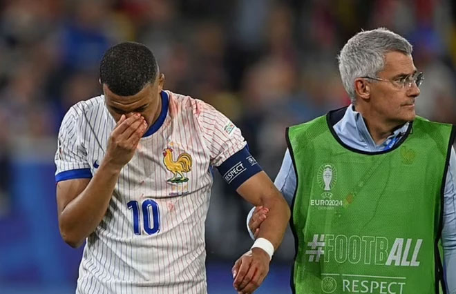 Ngôi sao số 1 của tuyển Pháp chấn thương kinh dị: Gãy mũi, đổ máu, phải đi thẳng vào bệnh viện-6