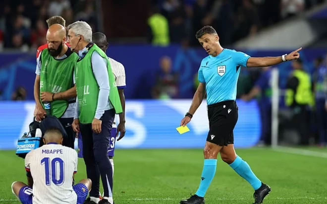 Ngôi sao số 1 của tuyển Pháp chấn thương kinh dị: Gãy mũi, đổ máu, phải đi thẳng vào bệnh viện-7