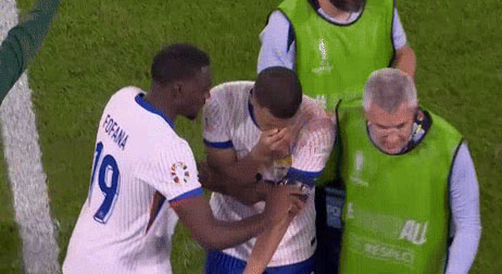 Ngôi sao số 1 của tuyển Pháp chấn thương kinh dị: Gãy mũi, đổ máu, phải đi thẳng vào bệnh viện-8