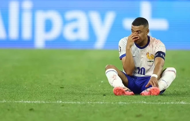 Ngôi sao số 1 của tuyển Pháp chấn thương kinh dị: Gãy mũi, đổ máu, phải đi thẳng vào bệnh viện-10