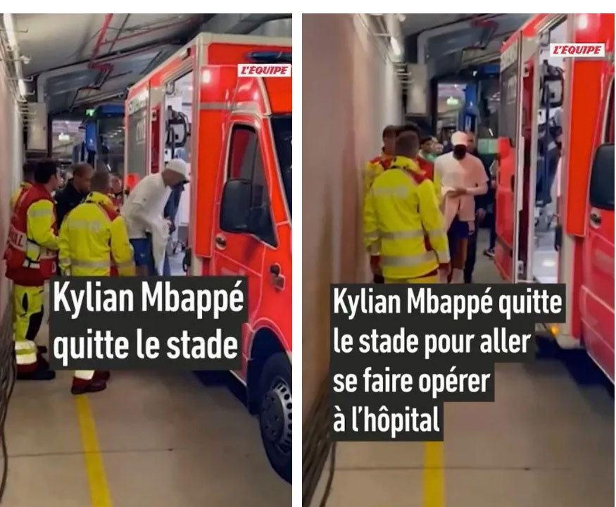 Ngôi sao số 1 của tuyển Pháp chấn thương kinh dị: Gãy mũi, đổ máu, phải đi thẳng vào bệnh viện-9